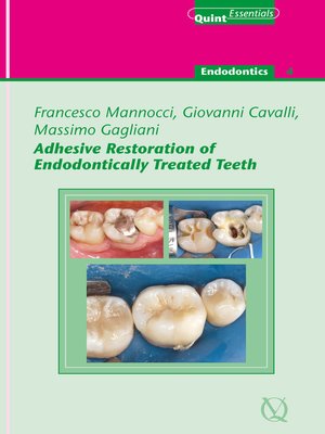 cover image of Adhesive Restoration of Endodontically Treated Teeth